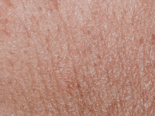 Dry-Dehydrated-Skin panchtattvashop