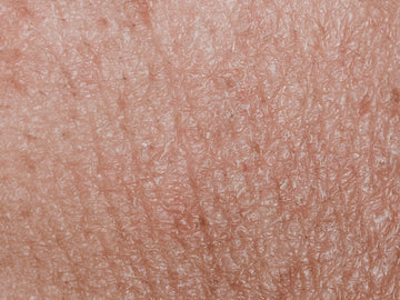 Dry-Dehydrated-Skin panchtattvashop